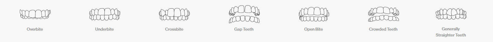 Invisalign can treat overbite, underbite, crossbite, gap teeth, open bite, crowded teeth, and generally straight teeth